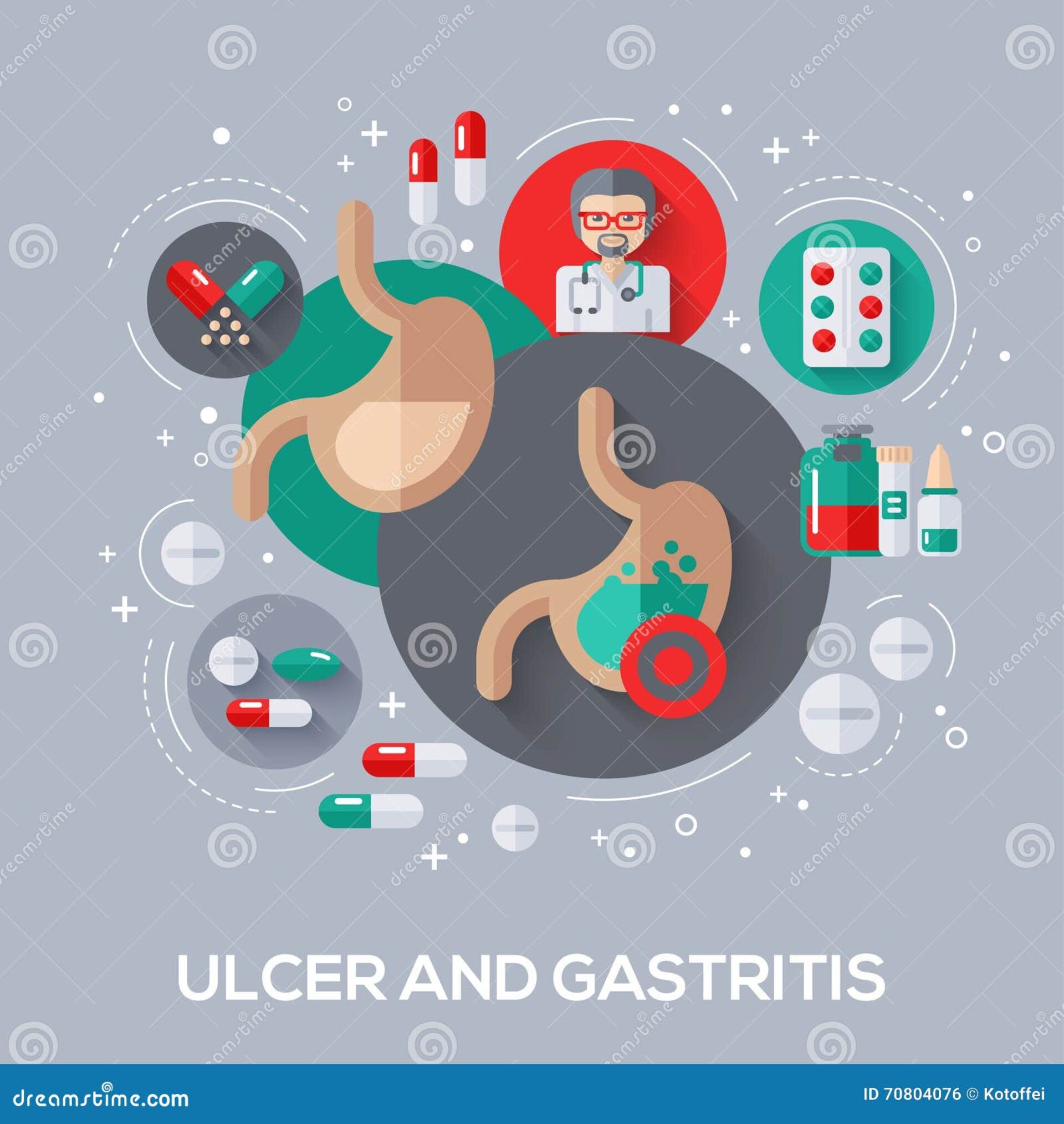Peptic Ulcer Treatment